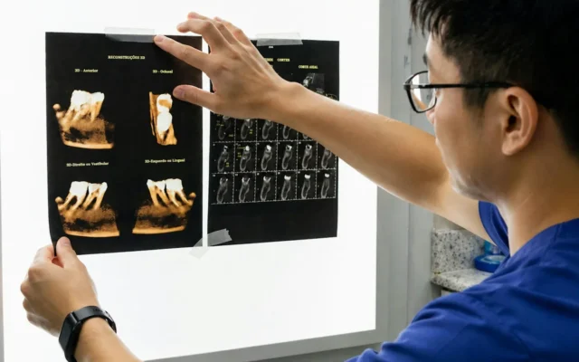 Medic care examinează imagini dentare pe un panou luminos